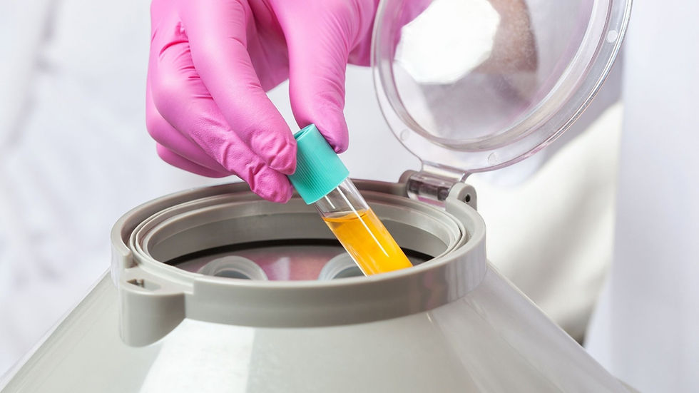 Platelet Rich Plasma Injections Near Houston, TX- Mila’s aesthetic Med spa
