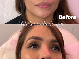 How to Fix Oily Face from Humidity: The Ultimate Guide to Matte, Balanced Skin