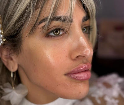 Houston TX: Botox Jaw Slimming and Jawline Contouring