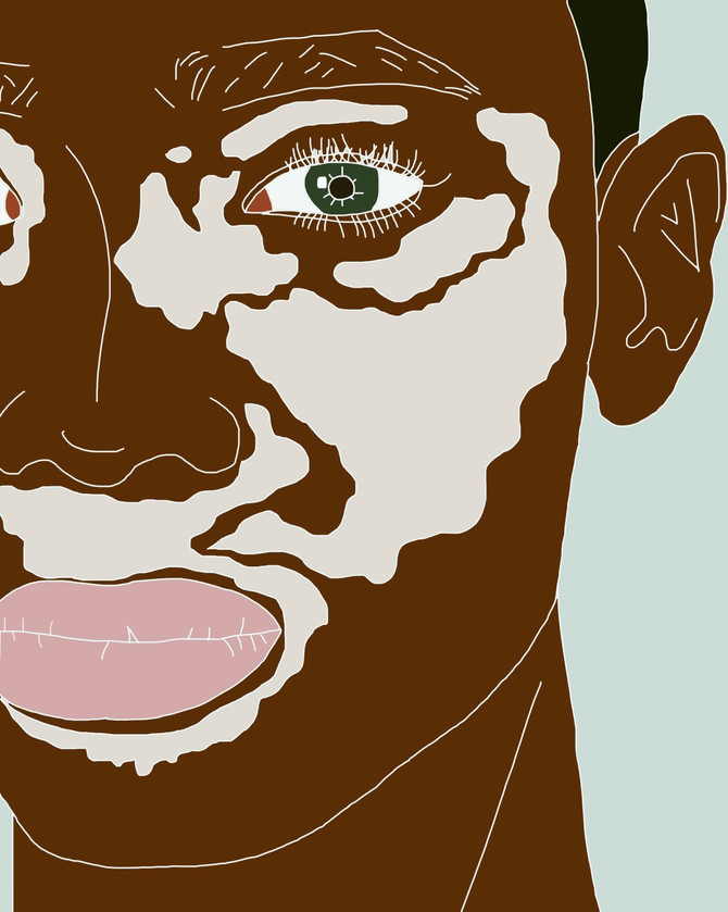 The Skin You're In: Life With Patches
