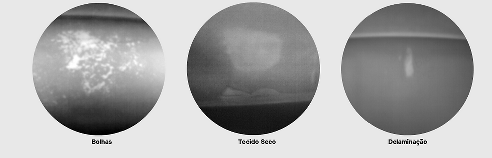 Bolhas, Tecido Seco e Determinação visto por imagem Infra Vermelho pela tecnologia Subiter 