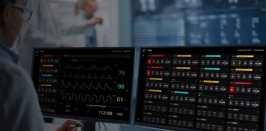 Your existing ICU set-up to a class of its own making it smarter and all set for tomorrow.