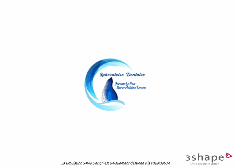 smile-design