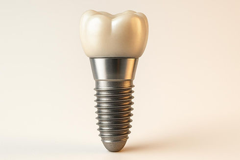 Dental-implant-smilesure-pune