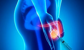 pulção testicular.jpg