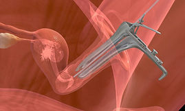 injuria-endometrial-clinica-sesma-1-1024x576.jpg