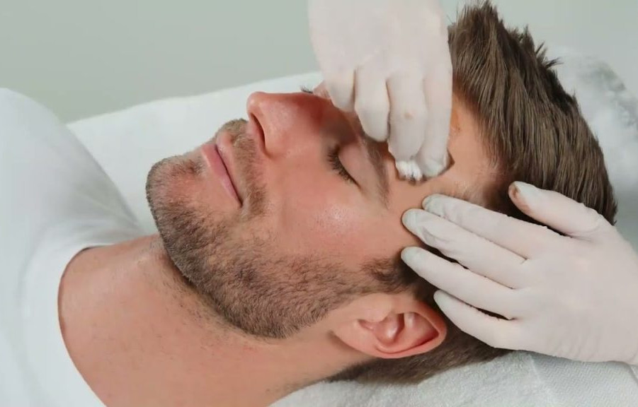 RevitalizingMensSkinTheBenefitsofChemicalPeelsatChicagoMaleSalon-1024x576.jpg