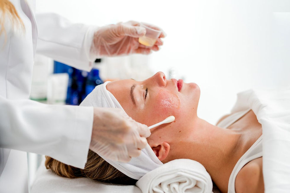 image-chemical-peel.jpg
