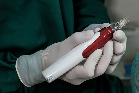 Laser Tattoo Removal