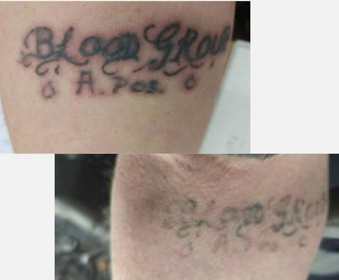 Before and After Service