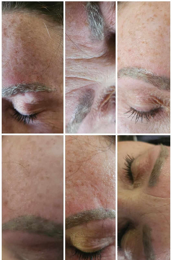 Before and After Service