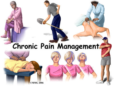 Chronic pain managemebnt
