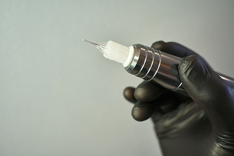 Cosmetic Tattoo Removal