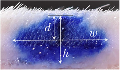Este dispositivo sustituye las agujas por un láser para inyectar vacunas bajo la piel...
