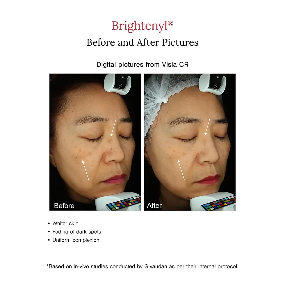 Thumbnail: 2% Alpha Arbutin + D-Gallic Acid Face Serum