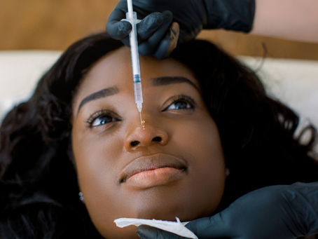 botox basics