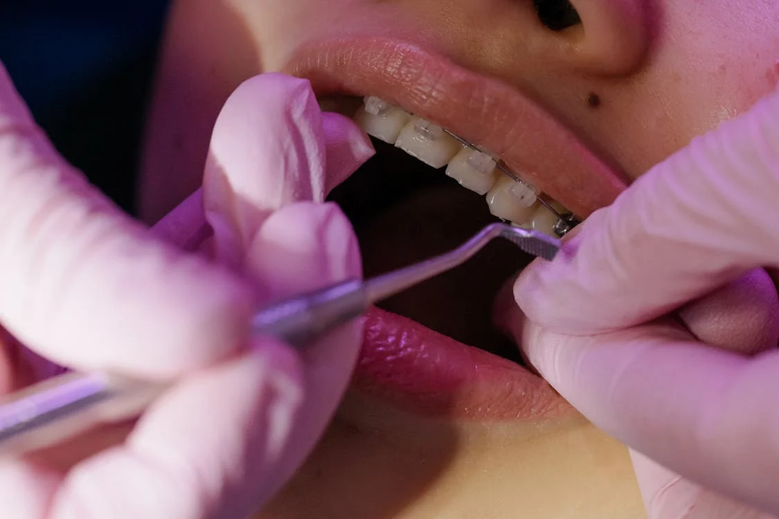 dental crown procedure