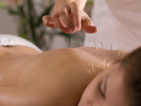10 Common Pain Conditions Relieved With Acupuncture