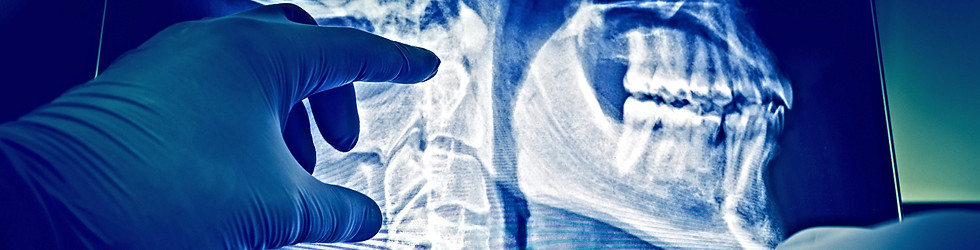 Spinal Cord Injury Treatment