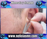 Esta es la verdadera razón por la que te salen pelos en las orejas: Descúbrelo todo aquí