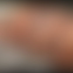 Los CDC vinculan un brote de salmonela con el retiro de 1,7 millones de huevos en nueve estados