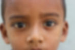 A kid with skin problems