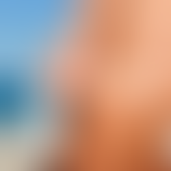 Sun-Kissed and Sun-Smart