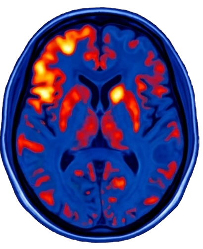 MIU CENTER_TMS_Brain activity_edited.png