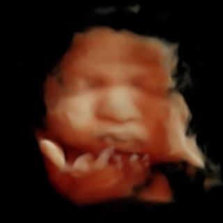 Baby pursing lips in 4D