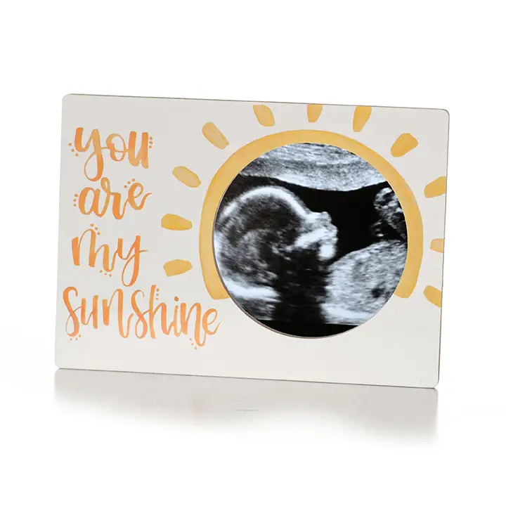 White and Yellow Picture Frame That Says You Are My Sunshine with a 2D Ultrasound Picture