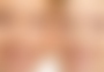 O SMAS E O ENVELHECIMENTO FACIAL por Dr. Leonardo Sauer