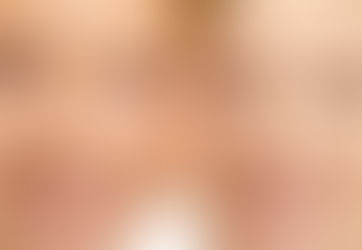 O SMAS E O ENVELHECIMENTO FACIAL por Dr. Leonardo Sauer
