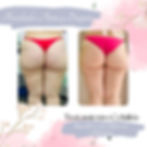 PaulaAndreaOsorioSpa_AntesdespuésCelulitis_May23
