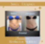 PaulaAndreaOsorioSpa_ResultadosReductorFrontal_Mar23