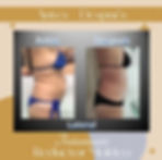 PaulaAndreaOsorioSpa_ResultadosReductorLateral_Mar23