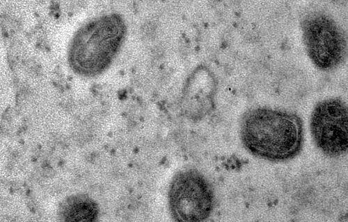 Mpox ainda é problema de saúde pública, dizem especialistas