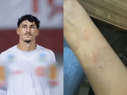 Jogador do Rio Verde é preso após denúncias de agressão e ameaças durante festa