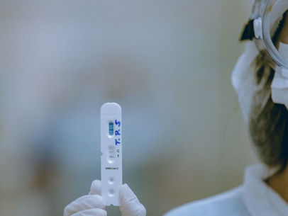 Prefeitura de Anápolis inicia testagem em massa para Covid-19