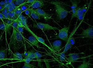 MAX_20211102_Im22_Neu_3011_MAP2488_SerT555_10.czi (RGB).jpg