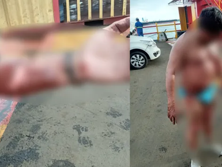 Explosão em balsa deixa quatro feridos no Porto da Ceasa; veja