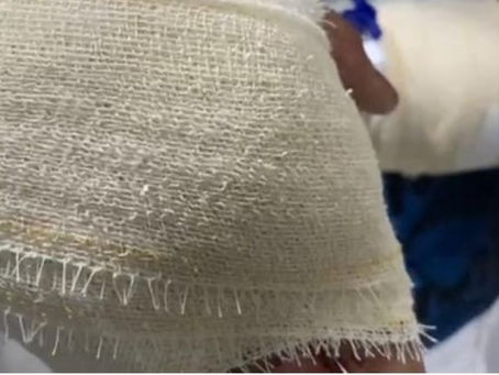 Jovem leva tiro na mão por demorar a entregar celular durante assalto em Manaus