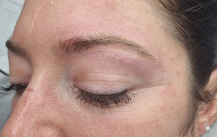 detatouage sourcils toulouse