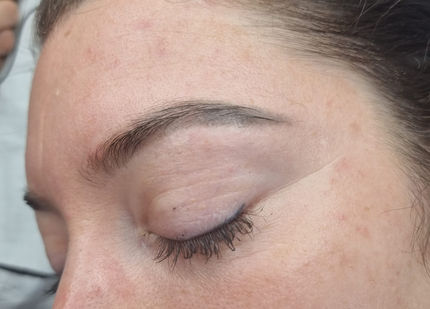 detatouage sourcils toulouse