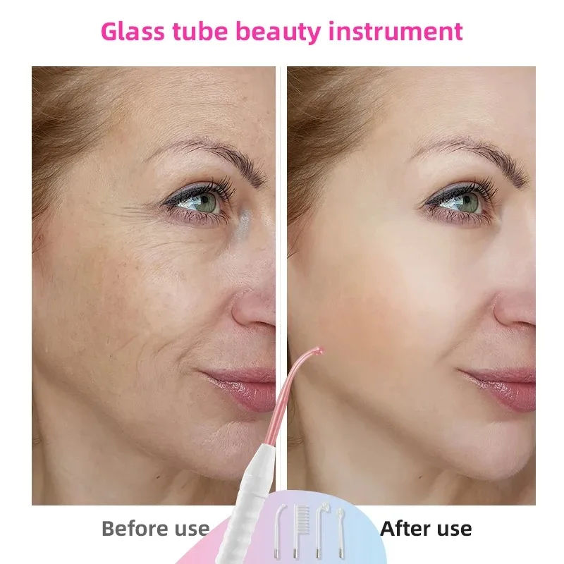 Thumbnail: 4-in-1 Acne Treatment Facial Device - Glass Electrode Therapy Wand for Spot Redu