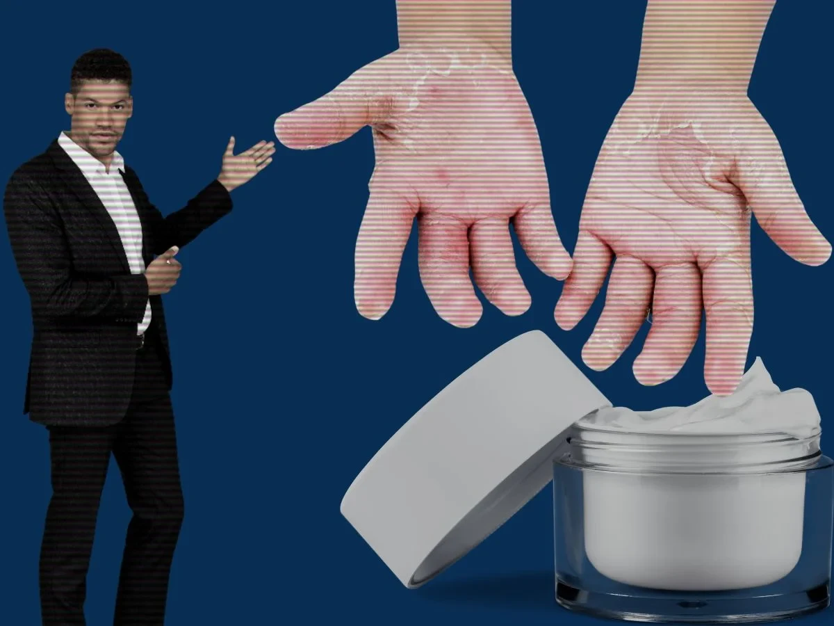 Banishing Dry Hands A Comprehensive Guide to Prevention, Treatment