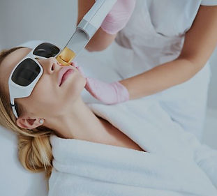 rosacea-treatment laser_edited.jpg