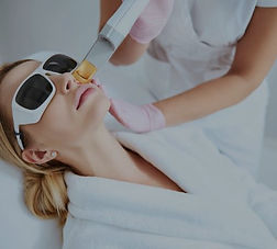 rosacea-treatment laser_edited_edited.jp