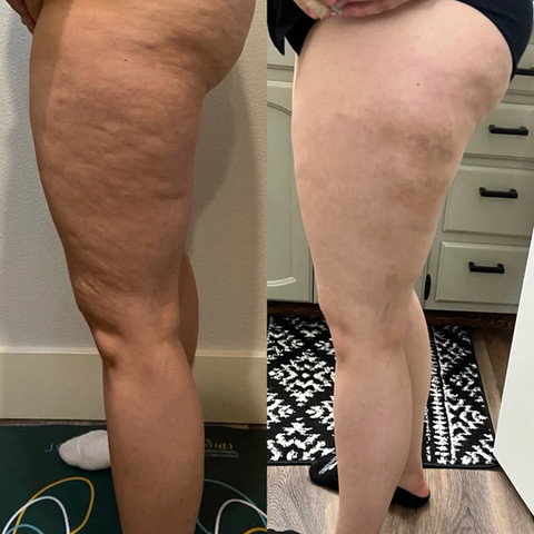 Before & After White Lotus Medical Aesthetics