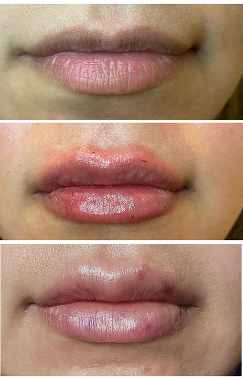 Before & After White Lotus Medical Aesthetics