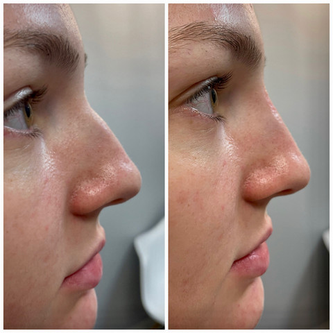Before & After White Lotus Medical Aesthetics